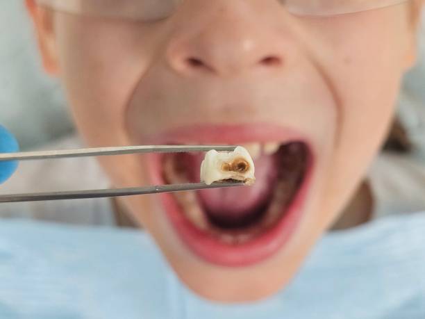 Best Emergency Gum Treatment in Garrett, IN